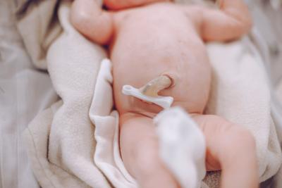 Pępek noworodka – jak dbać o pępek noworodka
